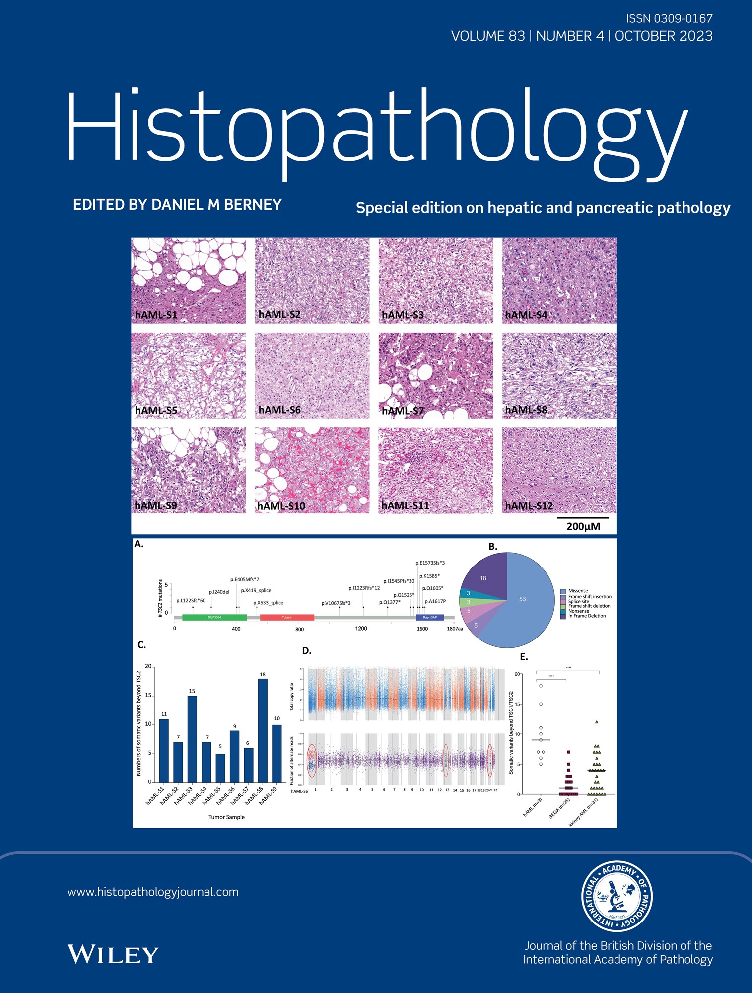 Histopathology Journal: Latest Issue Now Available image